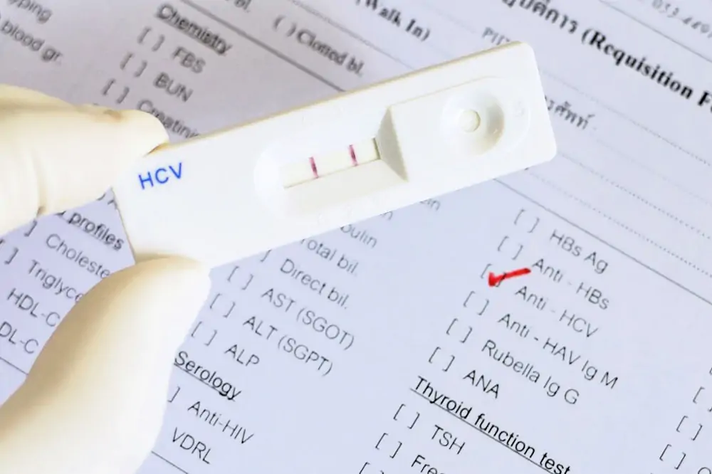 Hrvatska mora povećati testiranje na hepatitis C kako bi ostvarila cilj eliminacije do 2030